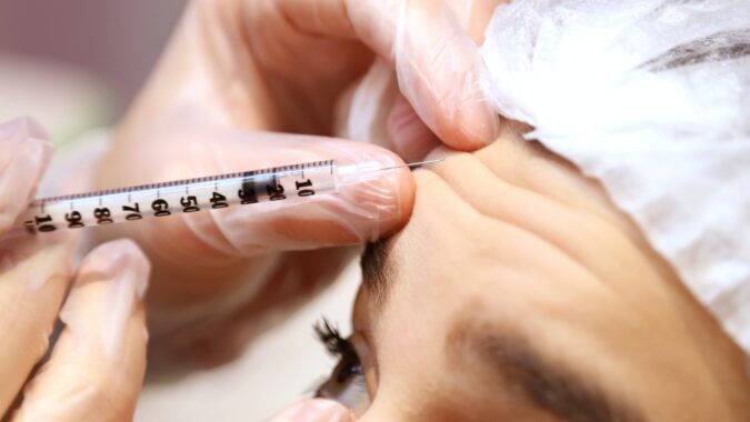 botox injection in woman's forehead.