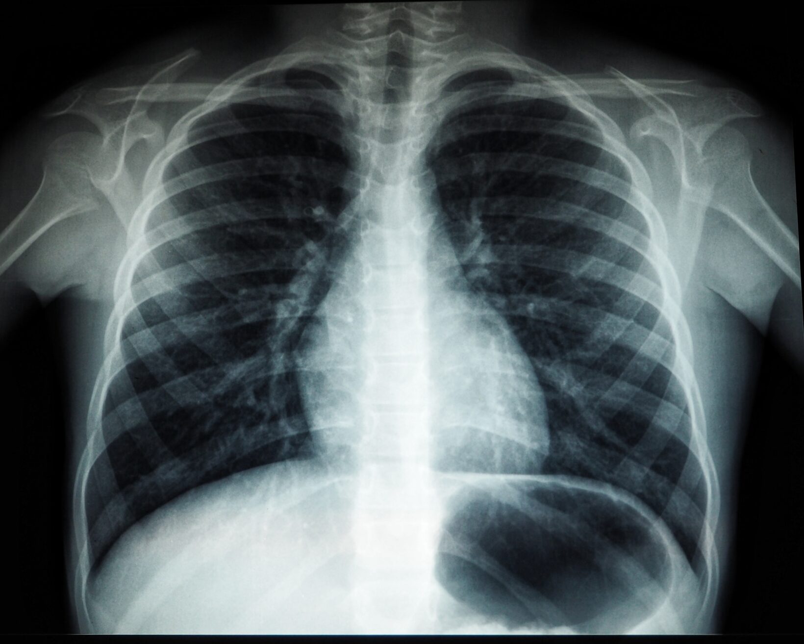 How to Dispose of Old Xrays Xray Recycling