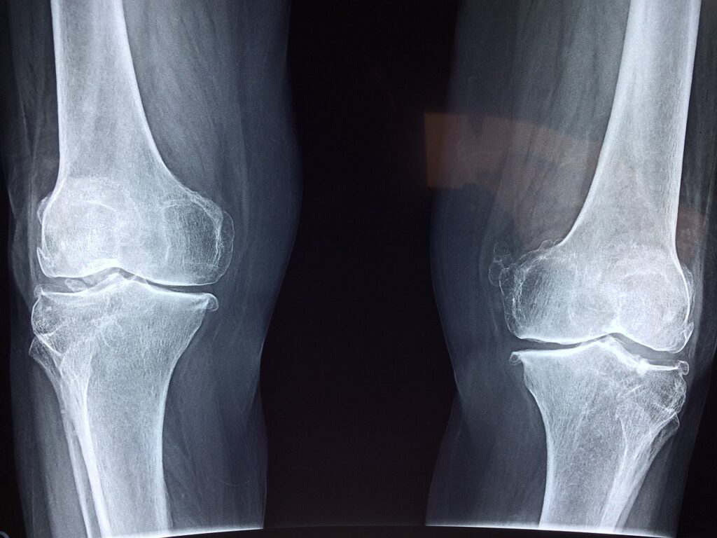 How to Dispose of Old Xrays Xray Recycling