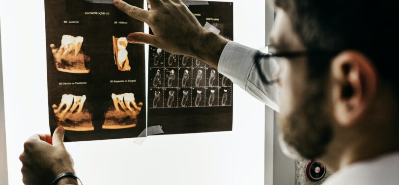 doctor holding up and looking at two x-rays.
