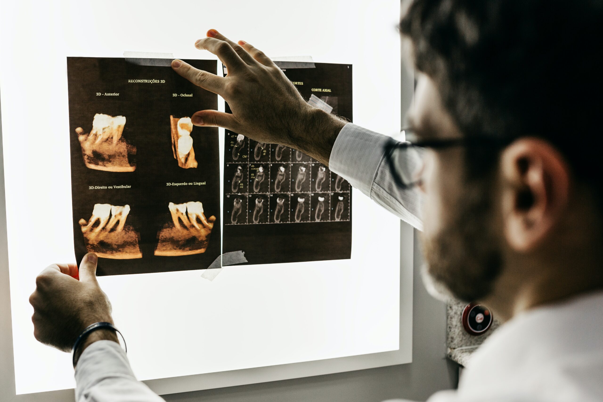 doctor holding up and looking at two x-rays.